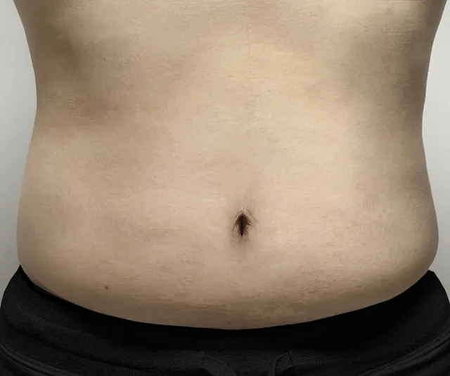 -4.7kg 第4周 81.1kg