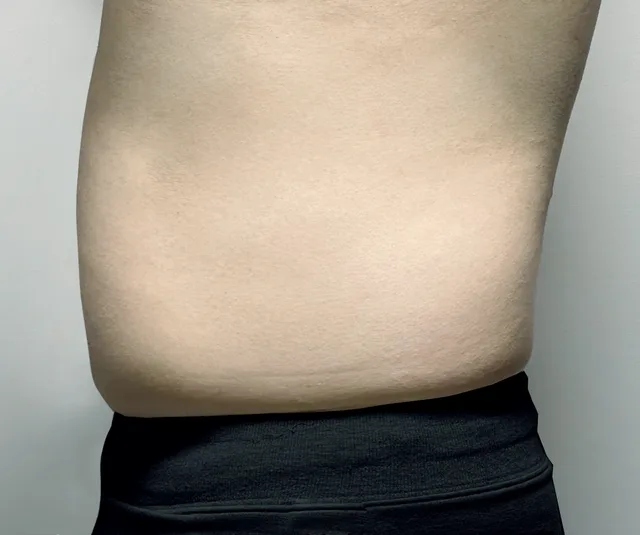 -4.7kg 第4周 81.1kg