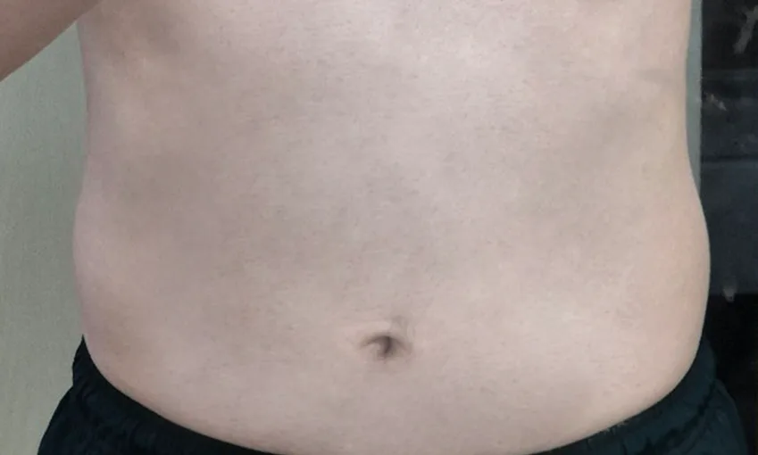 -7.0kg 第6周 93.0kg